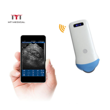 MT-M5B 128 elements B/W mini wireless handheld ultrasound  Micro convex probe for Cardiology/pediatric/pet